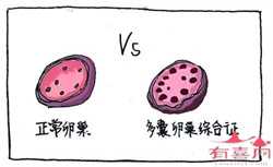 广州借卵生子费用，免疫性不孕的治疗特点