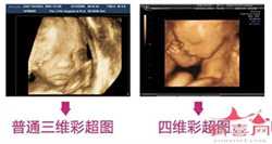 广州正规代怀公司推荐，做试管婴儿哪家医院好