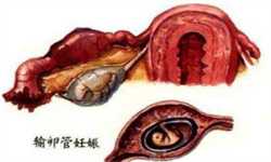 广州供卵试管不像自己，卵巢功能看哪个指标