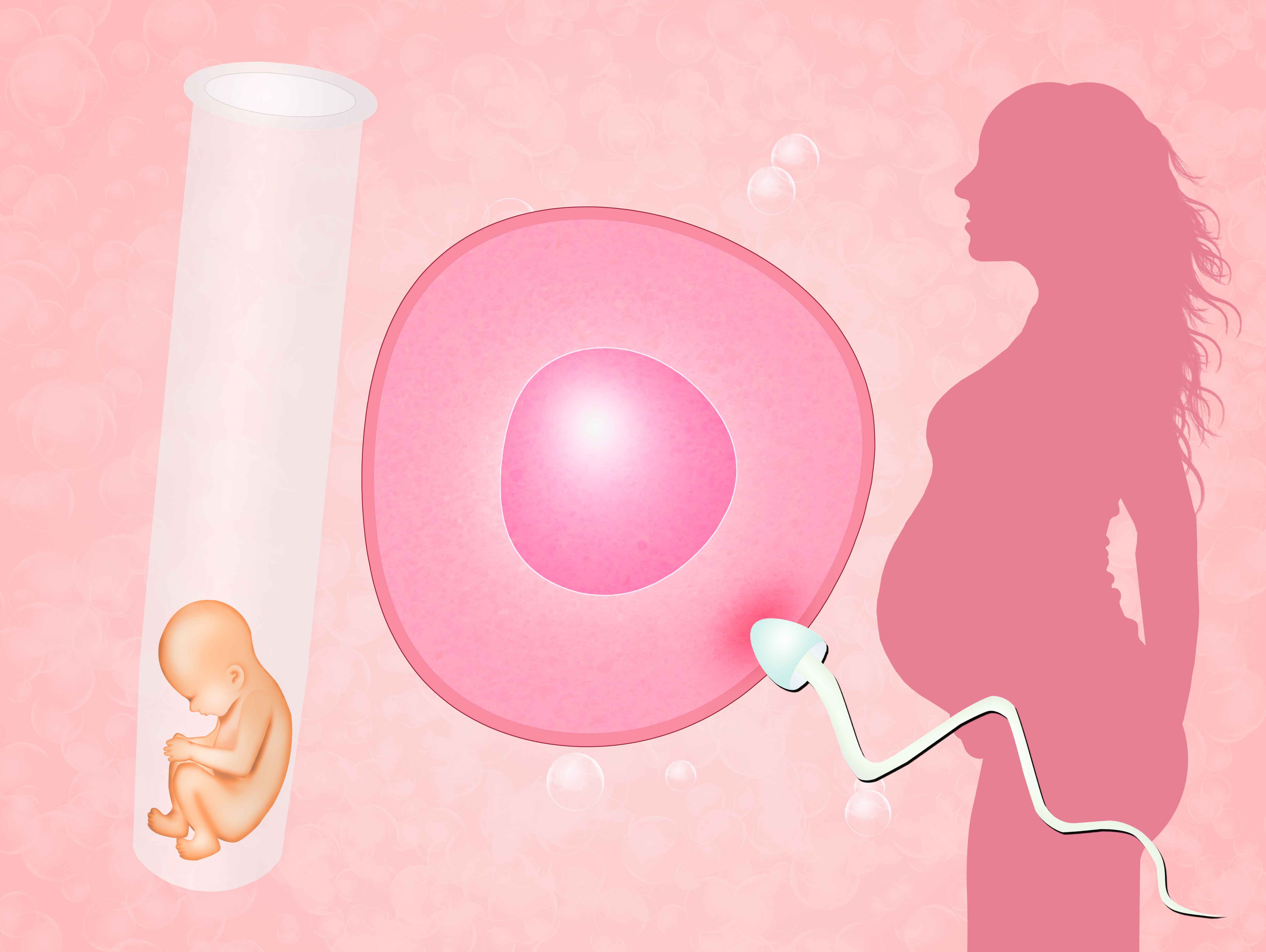 广州2022代怀孕多少钱，【子宫肌瘤能做供卵试管吗】造影加介入归来，现在两