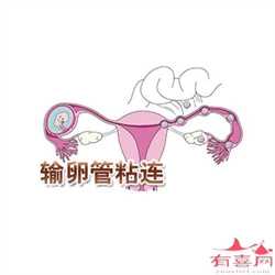 广州代生双胞胎中介，【51岁供卵能成功吗】去医院官宣，宝宝我来啦，好孕传