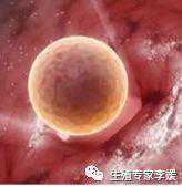 什么是胚胎移植，风险系数高吗？