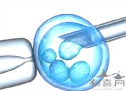 广州助孕中介服务，广州供卵试管医院：南方3
